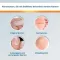 ENDWARTS Solution classique, 3 ml